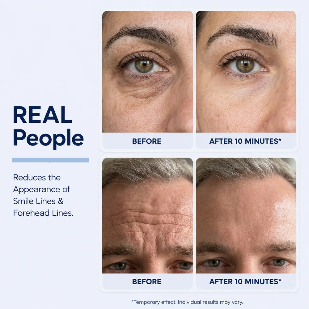 Eye serum real people before and after results