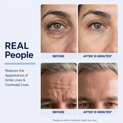 Rapid Reduction Serum
