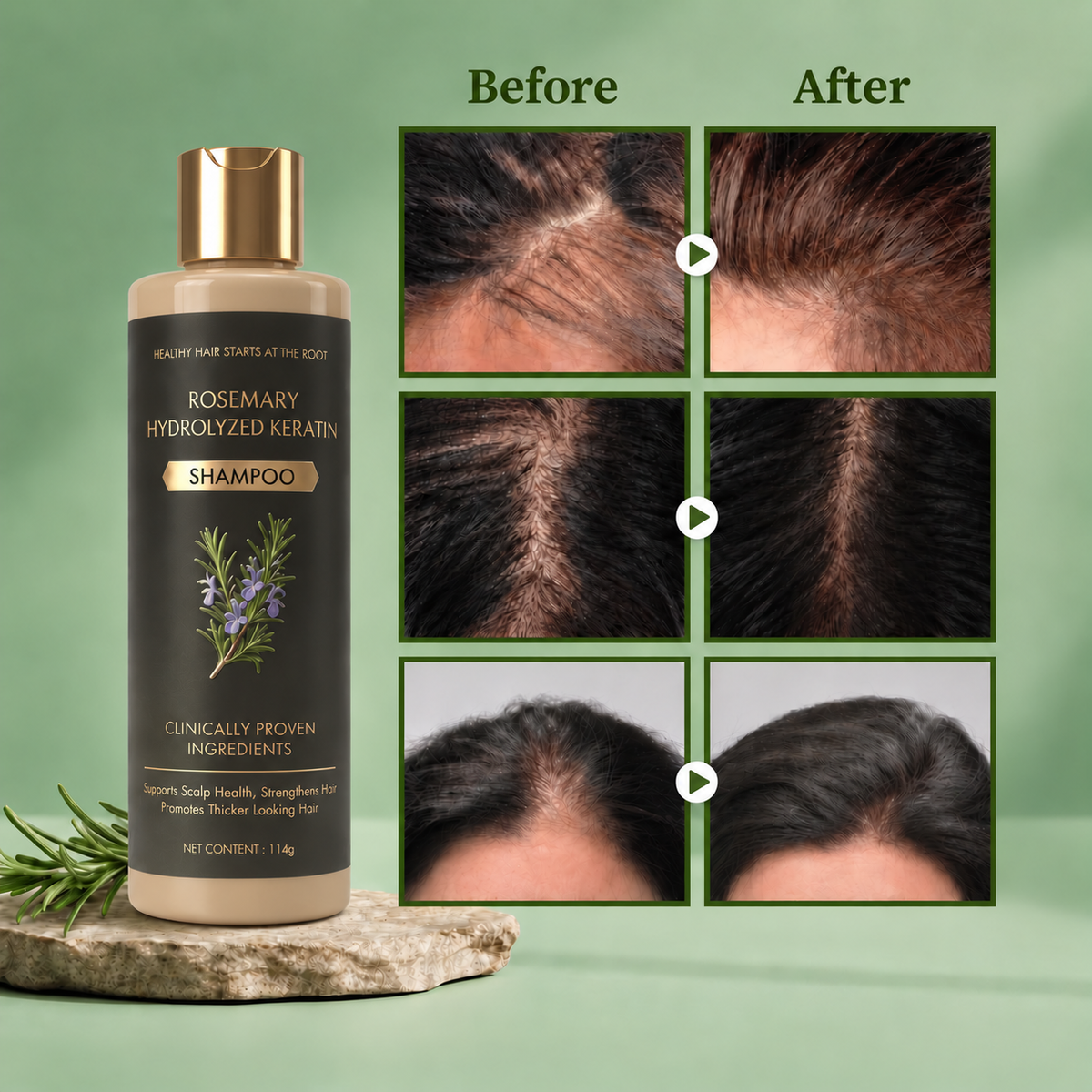 Growth-Support Shampoo - 2-Pack