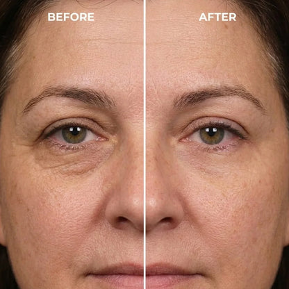 Rapid Reduction Serum