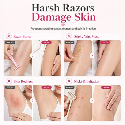 💥2026 HOT SALE💞50K+ SOLD! ✨ 50% OFF!💥Gentle Smooth Roll-On Body Hair Removal